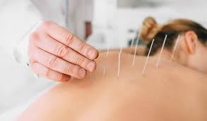  CERTIFICATE IN DE-ADDICTION BY ACUPUNCTURE